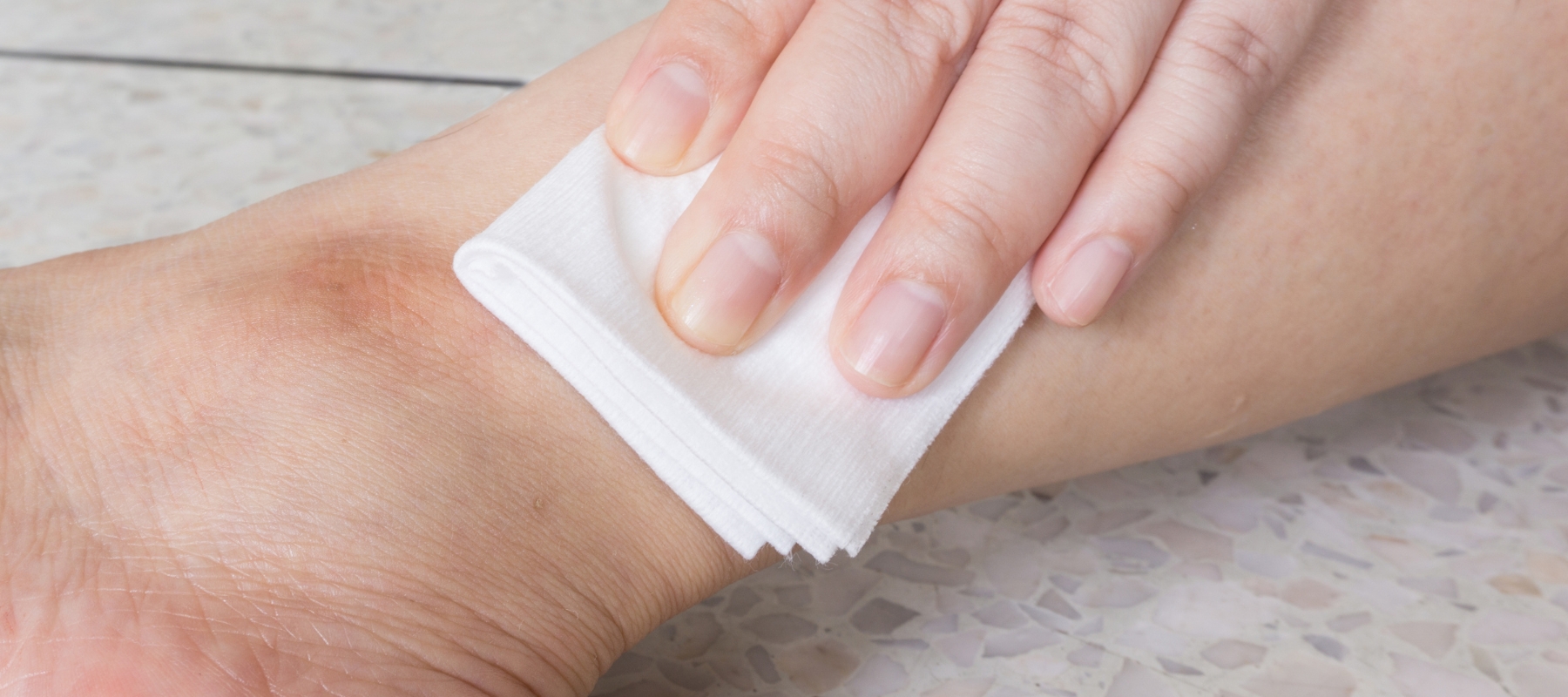 crème cicatrisante pour accélérer la cicatrisation