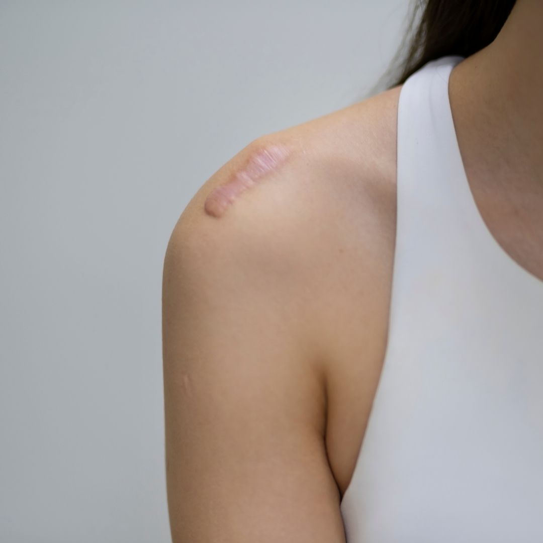 Save & Close  Irritations cutanées