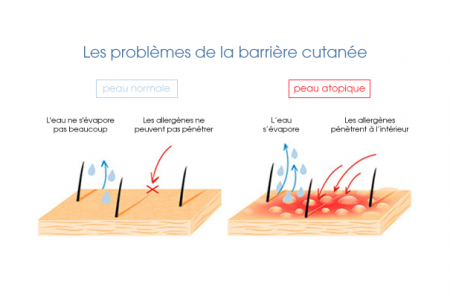 Schéma des problèmes peau et eczéma